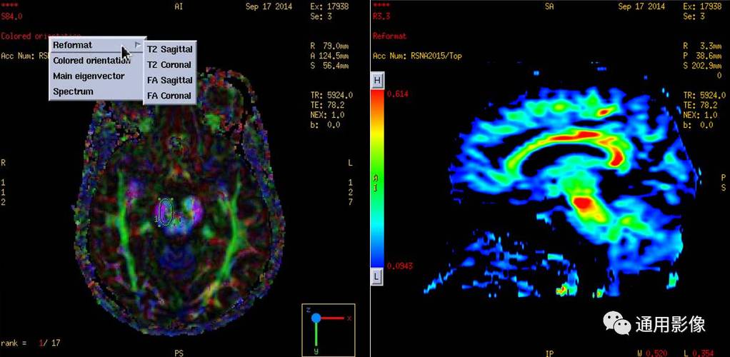 DTI參數的分析 DTI參數的分析 - BIM,Reivt中文網